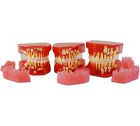 Modèle d'alternance de dents caduques et permanentes 3 pièces, modèle de développement dentaire détachable, de dents caduques de 3-6/5-9/9-12 ans, for outil de démonstration de la cavité