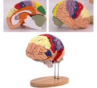 Modèle d'anatomie cérébrale pour l'enseignement et l'étude des maladies | Modèle d'anatomie cérébrale pour l'éducation en neurologie, idéal pour les étudiants et les professionnels qui étudient les