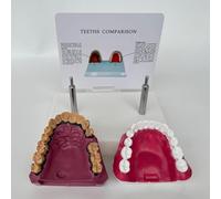 Modèle d'anatomie de la cavité buccale avec des caractéristiques | Modèle comparatif des dents qui fument et des dents saines, réplique de l'enseignement dentaire for les étudiants