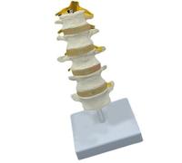 Modèle d'anatomie de la colonne lombaire humaine à cinq segments avec 5 vertèbres, sacre et nerfs rachidiens pour l'enseignement de la hernie discale intervertébrale