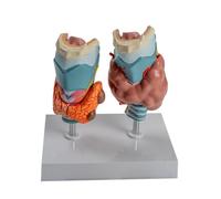 Modèle d'anatomie de la glande thyroïde Humaine Normale et pathologique, spécimen de maladie thyroïdienne pour l'enseignement médical en ORL et endocrinologie
