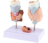 Modèle d'anatomie de la thyroïde humaine, modèle médical détachable de pathologie de la thyroïde en 4 parties, avec base de support, for la physiologie de l'éducation des études médicales