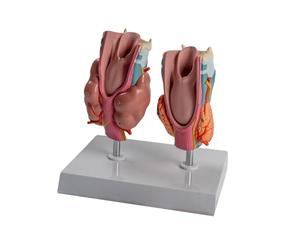 Modèle d'anatomie de la thyroïde pathologique humaine - Aide pédagogique - Modèle anatomique et pathologique pour la gorge - Pour une utilisation éducative
