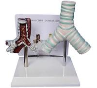 Modèle d'anatomie de la trachée humaine, modèle de comparaison de la trachée fumante et de la trachée normale, anatomie des organes de la structure du système respiratoire, for l'affichage