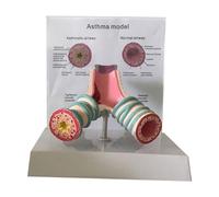 Modèle d'anatomie de l'asthme - Modèle bronchique du système respiratoire pour étudier et enseigner les étudiants