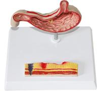 Modèle d'anatomie de l'estomac humain pour l'enseignement de la pathologie | Modèle d'anatomie de l'estomac à usage éducatif, idéal pour l'enseignement de la pathologie et des sciences de la santé