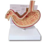 Modèle d'anatomie de l'estomac, modèle démonstration maladie, d'estomac pathologique