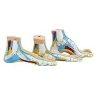 Modèle d'anatomie de pathologie du pied humain - Ensemble de 3 pièces comprenant des pieds plats, des voûtes hautes et des pieds normaux avec cartes d'explication pour l'enseignement médical