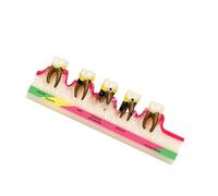Modèle d'anatomie de pathologie parodontale adulte à code couleur | Modèle d'anatomie en PVC coloré réaliste pour l'éducation et l'enseignement démonstration pour le cadre clinique