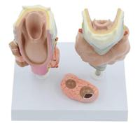 Modèle d'anatomie de pathologie thyroïdienne humaine, ensemble de modèles thyroïdiens, modèle de maladie thyroïdienne humaine avec carte d'instructions, for l'enseignement médical
