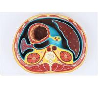 Modèle d'anatomie de section transversale thoracique et abdominale, modèle d'enseignement de section horizontale avec vertèbres thoraciques, foie, intestins et muscles