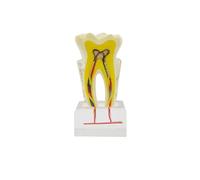 Modèle d'anatomie Dentaire 6X Modèle de pathologie Nerf Dentaire Enseignement Anatomie Modèle de dent for l'éducation des Patients Modèle de Canal radiculaire Modèle de dent for l'enseignement
