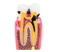 Modèle d'anatomie dentaire, modèle de dents durable pour les soins bucco-dentaires