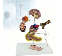 Modèle d'anatomie des complications du diabète en 8 pièces | Kit éducatif d'anatomie de 8 pièces for la communication médecin-patient et l'apprentissage de la physiologie.
