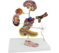 Modèle d'anatomie des complications du diabète Humain, Ensemble Complet d'organes avec Cerveau, cœur, pancréas, Nerf et Structure du Pied pour l'éducation médicale