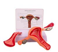 Modèle d'anatomie des organes reproducteurs féminins, modèle d'ovaire de l'utérus pathologique humain, aide pédagogique à la dissection de la maladie de l'ovaire de l'utérus,(Normal)