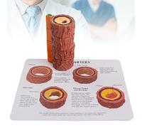 Modèle D'anatomie des Vaisseaux Sanguins de L'artère Humaine, Modèle D'artériosclérose en 4 étapes, Modèle Anatomique de L'artère Humaine pour l'enseignement de L'éducation Médicale