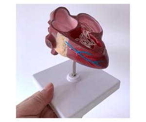 Modèle d'anatomie du cœur et du ver du cœur pour chien, construit avec des ventricules et des vaisseaux sanguins, équipé d'une base amovible, parfait pour l'éducation vétérinaire et l'enseignement.