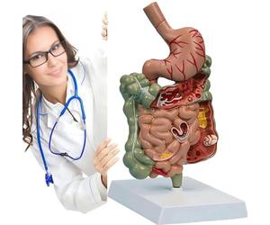 Modèle d'anatomie du système digestif Humain - Section détaillée de l'estomac et des intestins avec caractéristiques pathologiques, Outil d'étude du côlon pour étudiants en médecine et Usage éducatif