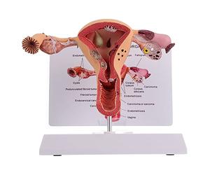 Modèle d'anatomie du système reproducteur féminin - Étude de pathologie des ovaires de l'utérus pour la formation médicale