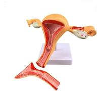 Modèle d'anatomie du vagin de l'ovaire de l'utérus normal féminin avec pièces amovibles Aide pédagogique en gynécologie for l'étude médicale en t le bureau du médecin