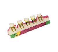 Modèle d'anatomie Équipement de Laboratoire de cavité buccale Dentiste Hygiène buccale Squelette de crâne Humain Maladie parodontale Anatomique Modèle de Classification des Dents Assorties