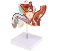 Modèle d'anatomie génitale masculine - Outil pédagogique sur les maladies urologiques for la formation médicale