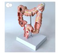 Modèle d'anatomie humaine 3D - Réplique du système digestif colique pour l'éducation d'anatomie et de physiologie