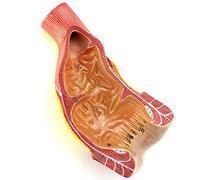 Modèle d'anatomie Humaine du Rectum et du Canal Anal digestif Humain Rectum Anus Canal Anatomique modèle structurel Rectum Anus Canal organe modèle 20X15x12cm modèle Squelette