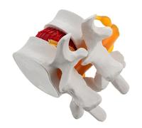 Modèle D'anatomie Lombaire en Pvc, Colonne Vertébrale D'entraînement | Surface Lisse et Lavable, Usage Pratique pour Éducation et Pratique, Blanc