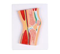 Modèle d'anatomie pédagogique de l'articulation du genou en PVC Modèle anatomique sectionnel d'articulation de la rotule pour l'éducation Clinique Modèle de genou en PVC