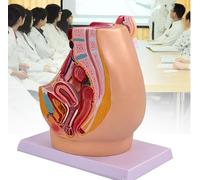 Modèle d'anatomie pelvienne féminine/masculine, modèle du système urinaire, outil d'enseignement anatomique des muscles du plancher pelvien en 4 parties pour démonstrations et cours(Female)