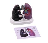 Modèle d'anatomie pulmonaire humaine anatomique, pathologique, modèle pulmonaire réaliste et pathologique, outil d'enseignement de l'anatomie
