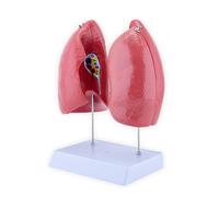 Modèle d'anatomie pulmonaire humaine éducative - Modèle anatomique pulmonaire humain avec composants détachables - Modèle d'anatomie pulmonaire normale - Modèle d'entraînement à l'hôpital