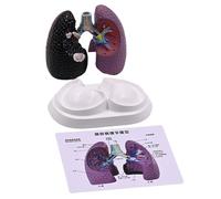 Modèle d'anatomie pulmonaire pathologique humaine - Modèle anatomique pulmonaire humain - Outil pédagogique en salle de classe - Outil d'enseignement pour le cadre clinique - Utilisation éduc