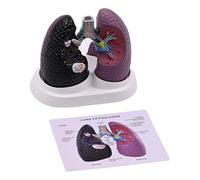 Modèle d'anatomie pulmonaire pathologique humaine - Modèle anatomique pulmonaire humain - Outil pédagogique en salle de classe - Outil d'enseignement pour le cadre clinique - Utilisation éduc