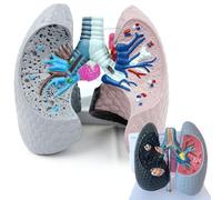 Modèle d'anatomie pulmonaire pathologique, poumon fumeur et modèle pulmonaire sain pour l'enseignement en classe
