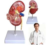 Modèle d'anatomie rénale grandeur nature avec carte éducative pour l'éducation des maladies et la démonstration scientifique