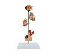Modèle d'anatomie rénale pathologique pour l'étude des maladies