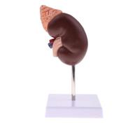 Modèle d'anatomie rénale Scientifique Cheotime, Affichage d'organes Humain en 2 Parties avec 24 marqueurs Outil éducatif codé en Couleur pour l'étude médicale et la démonstration