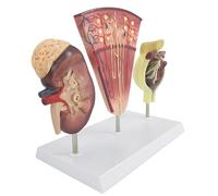 Modèle d'anatomie rénale, structure néphron et glomérule en 3 parties pour étudiants et urologues, modèle rénal éducatif pour consultation des patients