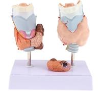 Modèle d'anatomie thyroïdienne, modèle de kyste de tumeur de la gorge, modèles d'anatomie normaux et malades avec pathologies, aides pédagogiques médicales, démonstration d'enseignement