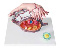 Modèle d'anatomie utérine, modèle d'anatomie des ovaires féminins en 3 Parties, modèle Anatomique du système génito-urinaire, pour Aide à la Formation en gynécologie médicale