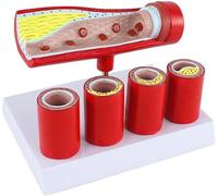 Modèle d'artère coronaire cardiovasculaire, modèle de sclérose artérielle de branche vieillissante, modèle de thrombose, modèle anatomique vasculaire pathologique amovible for l'enseignement