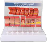 Modèle d'artères à visée pédagogique : Anatomie des artères, Modèle cardiovasculaire Humain (7 pièces), Formation cardiovasculaire complète, Athérosclérose Obstructive