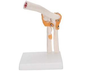 Modèle D'articulation du Coude, Modèle D'articulation du Coude Grandeur Nature Modèle de Squelette de Coude Précis Modèle D'articulation D'épaule Désossée pour L'enseignement de L'affichage de L'étude