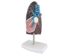 Modèle d'assemblage d'organes pulmonaires, modèle anatomique, anatomie pathologique humaine, du système respiratoire