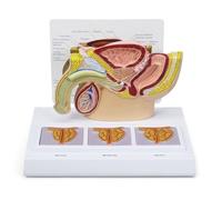 Modèle de bassin masculin, anatomie humaine avec cadre prostatique 3D for l'enseignement de la physiologie, les cabinets médicaux, les salles de classe et les ressources d'apprentissage médical.