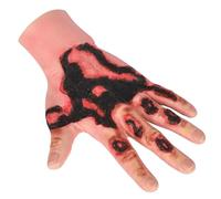 Modèle de blessure simulé par silicone portable de brûlure, entraîneur d'emballage de blessure de brûlure, conception réaliste d'aspect, pour la formation de soin de blessure