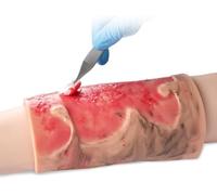 Modèle de brûlure, simulateur portable de brûlures de membres en silicone, module de formation sur les brûlures de membres à 2-3 degrés for les soins, démonstration d'enseignement médical.